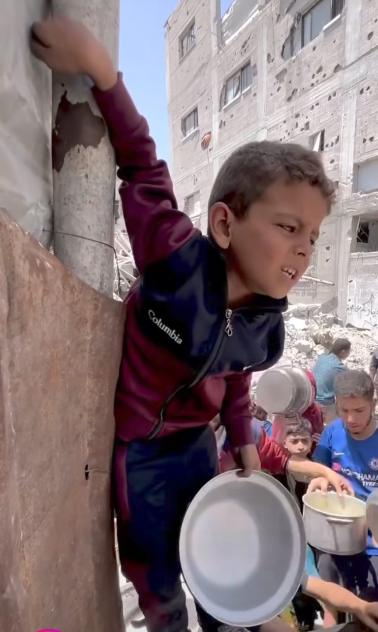 Gaza: Starvation Grips Palestinian Children Amid Allegations of Deliberate Aid Obstruction